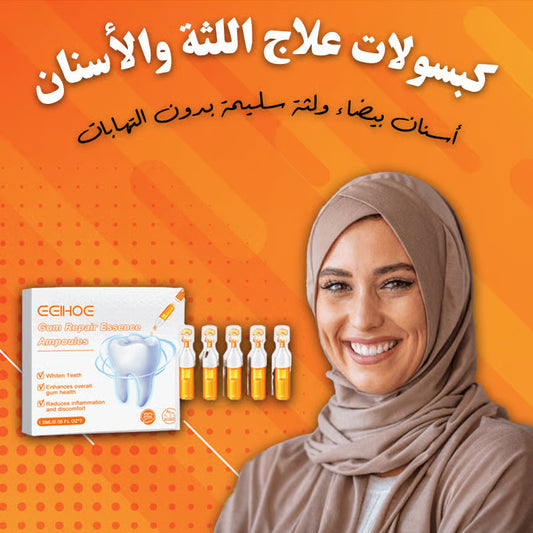 اللثة